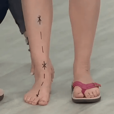 Daryl™ Orthopedic Sandals